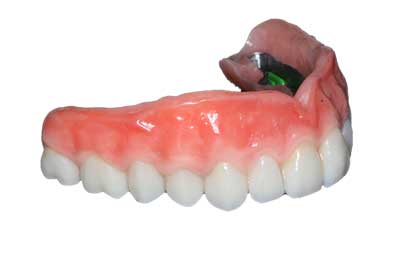 Dental Centre Maroochydore - Dentures